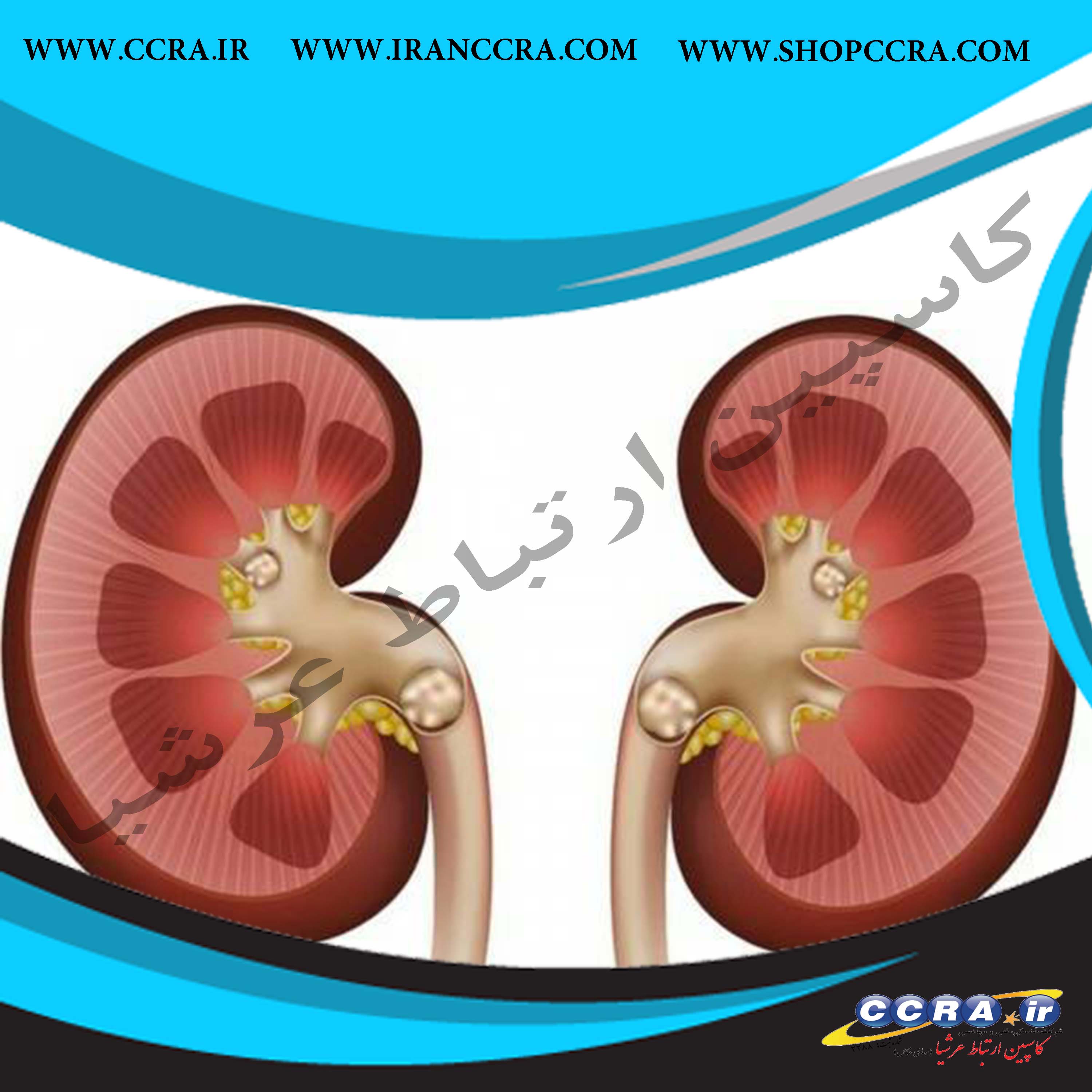 درمان سنگ کلیه با مصرف آب سالم در خانه